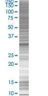 Other: TZFP 293T Cell Transient Overexpression Lysate [H00027033-T02]
