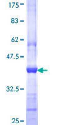 SDS-PAGE: Recombinant Human PIB5PA GST (N-Term) Protein [H00027124-Q01]