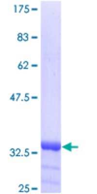 SDS-PAGE: Recombinant Human Inversin GST (N-Term) Protein [H00027130-P01]