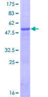 SDS-PAGE: Recombinant Human CIDEB GST (N-Term) Protein [H00027141-P02]