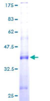 SDS-PAGE: Recombinant Human SPCS1 GST (N-Term) Protein [H00028972-P01]