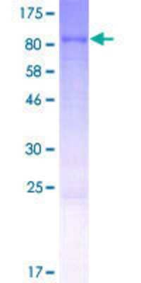 SDS-PAGE: Recombinant Human ASTE1 GST (N-Term) Protein [H00028990-P01]