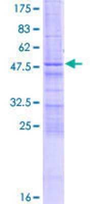 SDS-PAGE: Recombinant Human ZCCHC4 GST (N-Term) Protein [H00029063-P01]