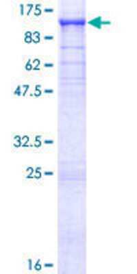 SDS-PAGE: Recombinant Human TBK1 GST (N-Term) Protein [H00029110-P01]