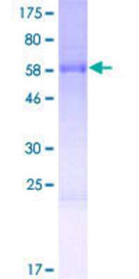 SDS-PAGE: Recombinant Human TFPT GST (N-Term) Protein [H00029844-P01]