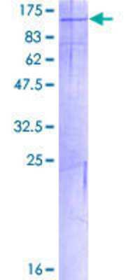 SDS-PAGE: Recombinant Human PKN3 GST (N-Term) Protein [H00029941-P01]