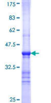 SDS-PAGE: Recombinant Human SG2NA GST (N-Term) Protein [H00029966-Q01]