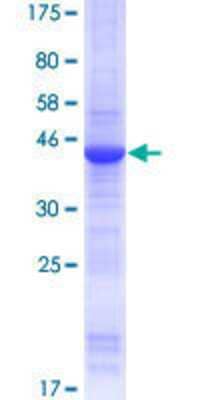 SDS-PAGE: Recombinant Human SPANXA1 GST (N-Term) Protein [H00030014-P01]