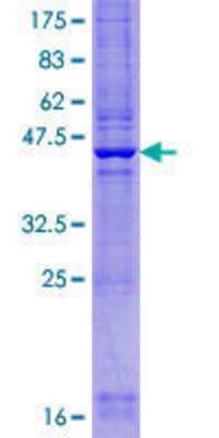 SDS-PAGE: Recombinant Human cysteine/histidine-rich 1 GST (N-Term) Protein [H00050626-P01]