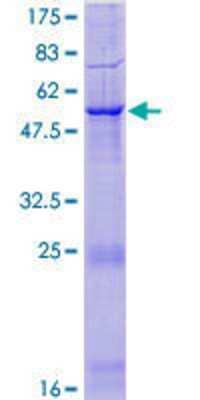 SDS-PAGE: Recombinant Human Protease Inhibitor 15 GST (N-Term) Protein [H00051050-P01]