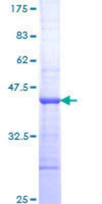 SDS-PAGE: Recombinant Human TNNI3K GST (N-Term) Protein [H00051086-Q01]