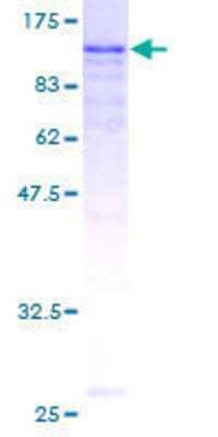 SDS-PAGE: Recombinant Human EPLIN GST (N-Term) Protein [H00051474-P01]