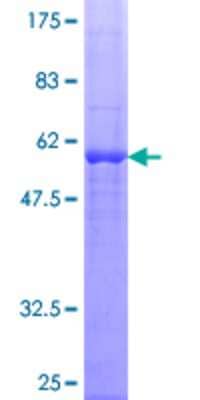 SDS-PAGE: Recombinant Human Dexras1 GST (N-Term) Protein [H00051655-P02]