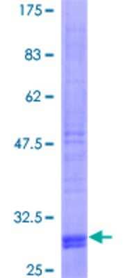 SDS-PAGE: Recombinant Human SLC38A2 GST (N-Term) Protein [H00054407-P02]