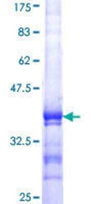 SDS-PAGE: Recombinant Human DGCR8 GST (N-Term) Protein [H00054487-Q01]