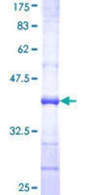 SDS-PAGE: Recombinant Human UGT1A6 GST (N-Term) Protein [H00054578-Q01]