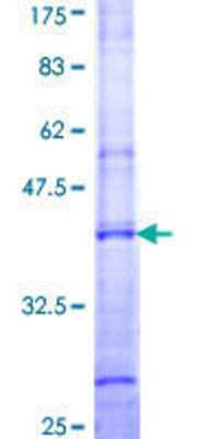 SDS-PAGE: Recombinant Human UGT1A4 GST (N-Term) Protein [H00054657-Q01]