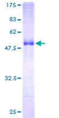 SDS-PAGE: Recombinant Human EPDR1 GST (N-Term) Protein [H00054749-P01]