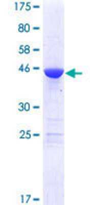 SDS-PAGE: Recombinant Human MED18 GST (N-Term) Protein [H00054797-P01]