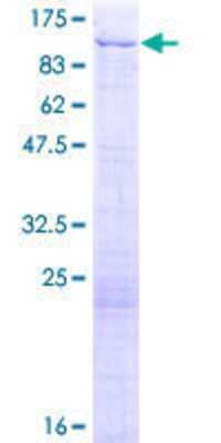 SDS-PAGE: Recombinant Human NSD3 GST (N-Term) Protein [H00054904-P01]