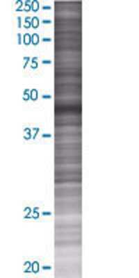 Other: TRIM62 293T Cell Transient Overexpression Lysate [H00055223-T01]