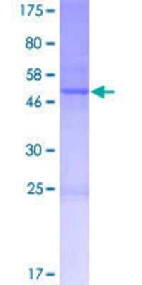 SDS-PAGE: Recombinant Human CNO GST (N-Term) Protein [H00055330-P01]