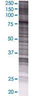 Other: SMPD3/NSMase2 293T Cell Transient Overexpression Lysate [H00055512-T01]