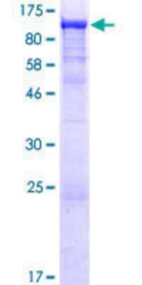 SDS-PAGE: Recombinant Human Smek1 GST (N-Term) Protein [H00055671-P01]