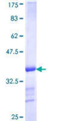 SDS-PAGE: Recombinant Human VPS35 GST (N-Term) Protein [H00055737-Q01]