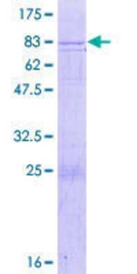 SDS-PAGE: Recombinant Human PEO1 GST (N-Term) Protein [H00056652-P01]