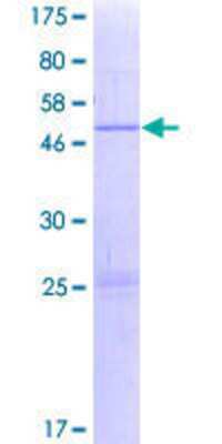 SDS-PAGE: Recombinant Human EMC7 GST (N-Term) Protein [H00056851-P01]