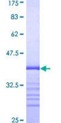 SDS-PAGE: Recombinant Human TMEPAI GST (N-Term) Protein [H00056937-Q01]