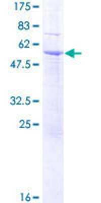 SDS-PAGE: Recombinant Human SDR39U1 GST (N-Term) Protein [H00056948-P01]