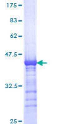 SDS-PAGE: Recombinant Human KIF15 GST (N-Term) Protein [H00056992-Q01]