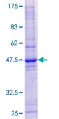 SDS-PAGE: Recombinant Human HRAS like suppressor GST (N-Term) Protein [H00057110-P01]