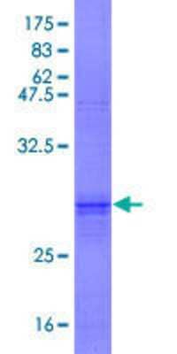 SDS-PAGE: Recombinant Human LCHN GST (N-Term) Protein [H00057189-P01]