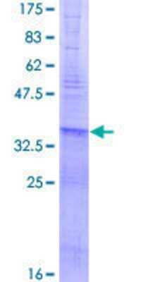 SDS-PAGE: Recombinant Human CNOT6 GST (N-Term) Protein [H00057472-P01]