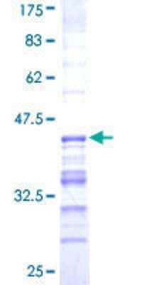 SDS-PAGE: Recombinant Human USP31 GST (N-Term) Protein [H00057478-Q01]