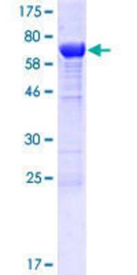 SDS-PAGE: Recombinant Human TLDC1 GST (N-Term) Protein [H00057707-P01]