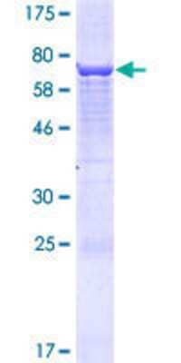 SDS-PAGE: Recombinant Human EPG5 GST (N-Term) Protein [H00057724-P01]