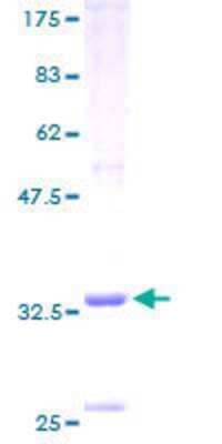 SDS-PAGE: Recombinant Human MARK4 GST (N-Term) Protein [H00057787-P01]