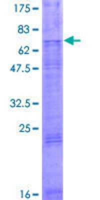 SDS-PAGE: Recombinant Human TSCOT GST (N-Term) Protein [H00057864-P01]