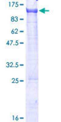 SDS-PAGE: Recombinant Human PCIF1 GST (N-Term) Protein [H00063935-P01]