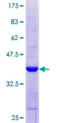 SDS-PAGE: Recombinant Human MDA5 GST (N-Term) Protein [H00064135-Q01]