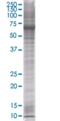 Other: ROBO3 293T Cell Transient Overexpression Lysate [H00064221-T01]