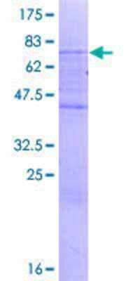 SDS-PAGE: Recombinant Human SMAP2 GST (N-Term) Protein [H00064744-P01]