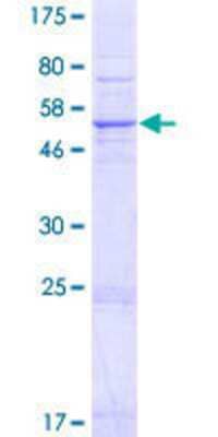 SDS-PAGE: Recombinant Human SRD5A3 GST (N-Term) Protein [H00079644-P01]