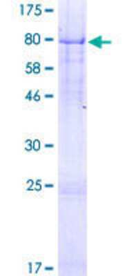 SDS-PAGE: Recombinant Human pre-mRNA cleavage factor I (59 kDa subunit) GST (N-Term) Protein [H00079869-P01]