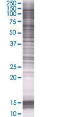 Other: AAVR/KIAA0319L 293T Cell Transient Overexpression Lysate [H00079932-T01]