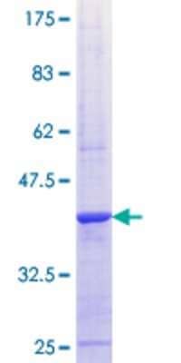 SDS-PAGE: Recombinant Human ALPK1 GST (N-Term) Protein [H00080216-Q01]